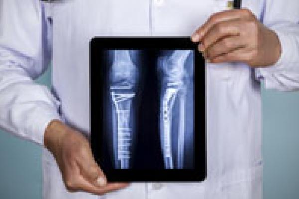 X-ray